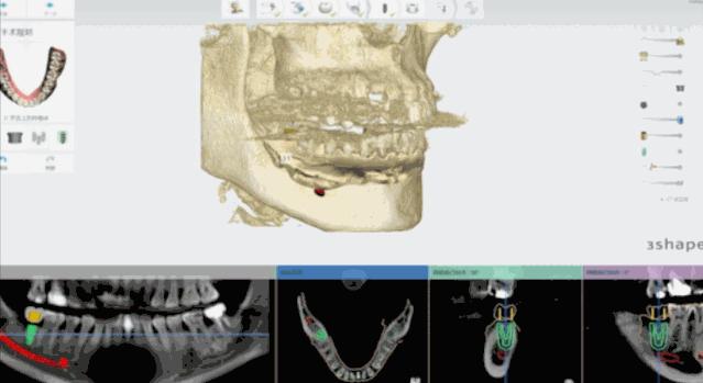 日照口腔牙齿矫正费用,日照牙科修牙多少钱一颗