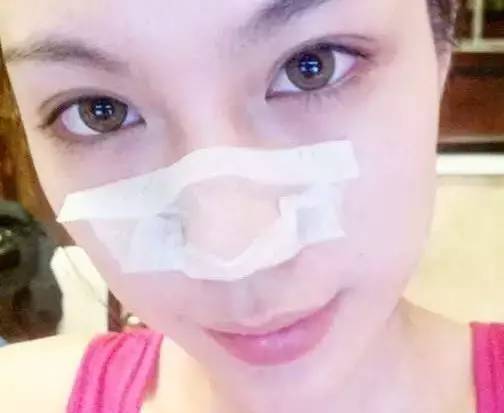 毛孔粗大、鼻子起皮是怎么引起的呢？日常护肤小常识帮你解决