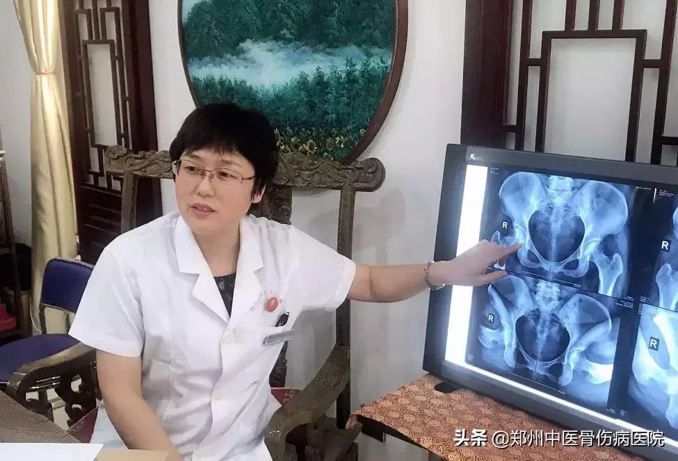 骨坏死是早期治疗好还是晚点治好,骨坏死预后治愈情况