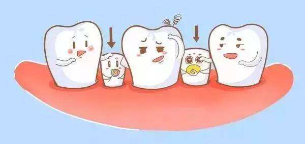 为迟来的恒牙占座—亿佰君谈间隙保持器