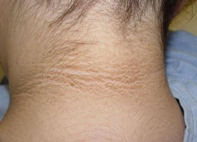 女儿脖子发黑洗不掉怎么办,15岁孩子脖子黑洗不掉是怎么回事