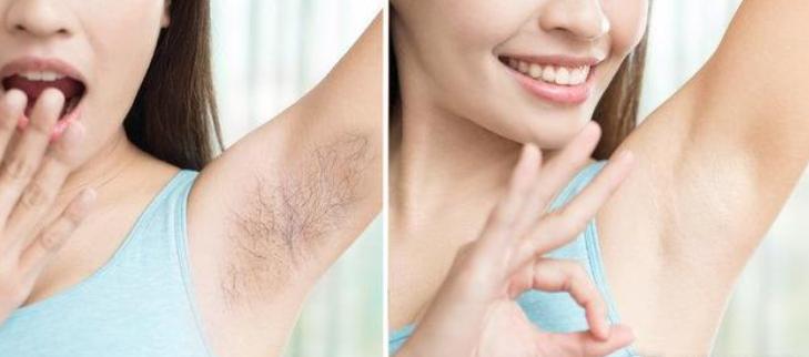 女性如何处理生理性毛发,为什么有的女人身上毛发特别浓密