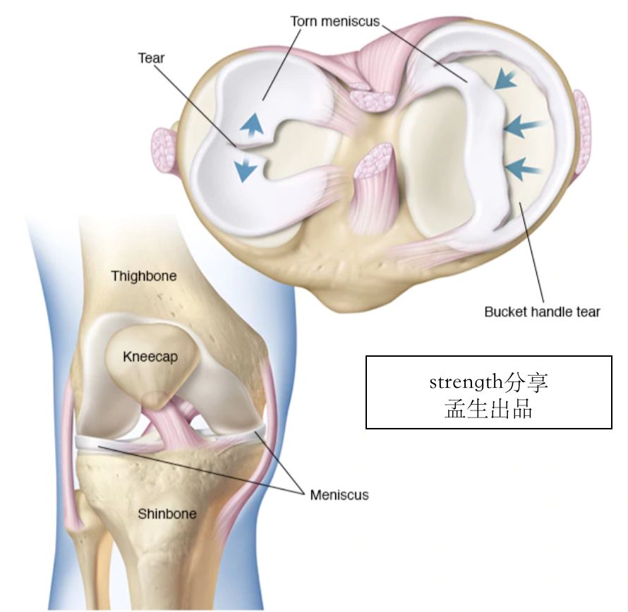 什么样的运动不伤骨头——越练越伤，了解你的软骨
