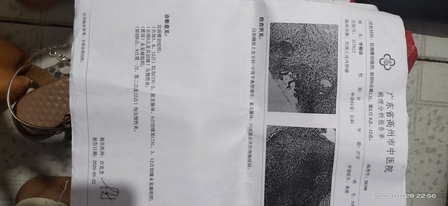 四个月的复查结果,四个月复查多了一个结节