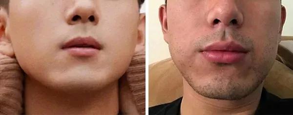 小米双头剃须刀怎么拆,小米剃须刀哪款剃最干净