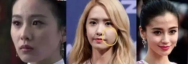 闭口挤了一直长怎么办,闭口到底要不要挤出来