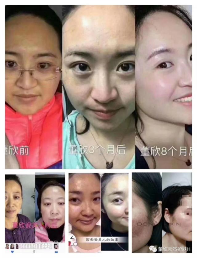 董欣瓷美人苹果干好用？董欣可靠吗？代理有啥要求？有图有真相！