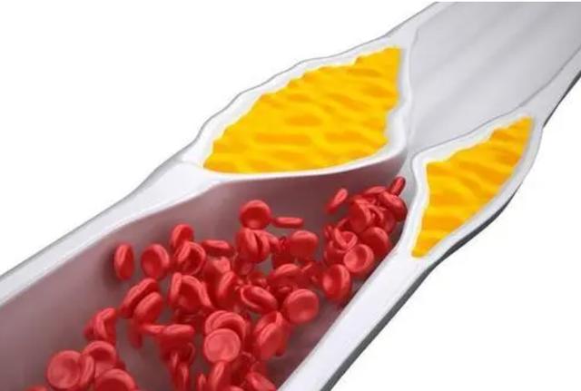 长期吃核桃对人有什么好处,经常吃核桃有哪些好处和坏处