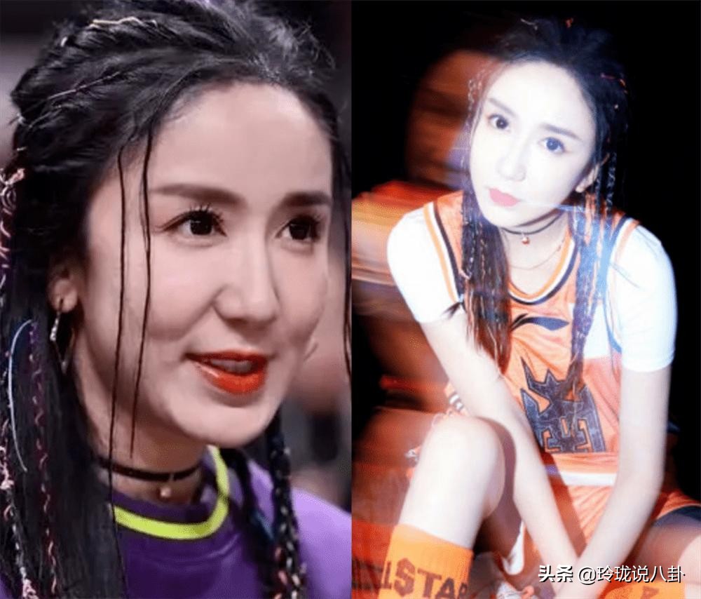 有哪些明星过度整容惨不忍睹,整容失败女明星今昔对比