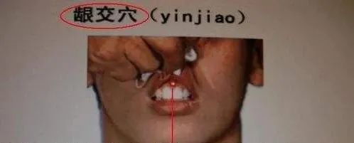 女子被放血治疗差点丧命,女子放血治好难言之隐