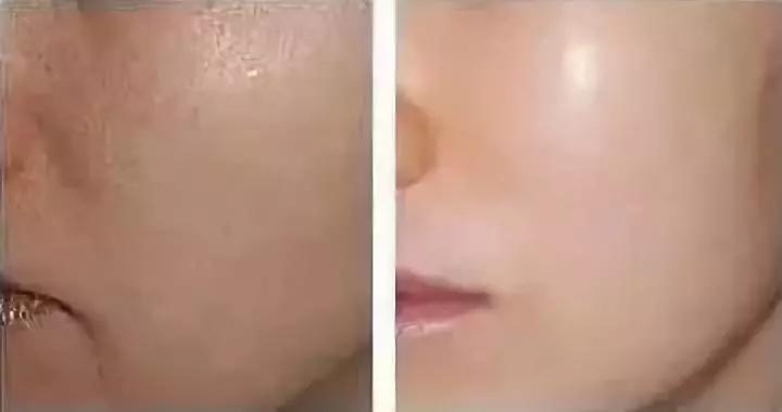 做医美的女生有多少,做医美的女生有什么特征