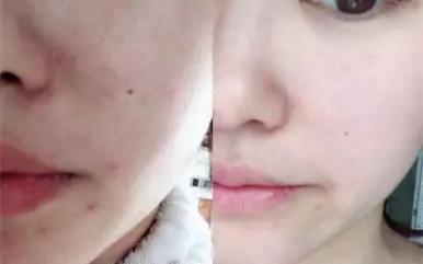 火山泥真是宝,油皮女孩的毛孔疏通剂,让贵妇霜3秒吃透锁水8倍