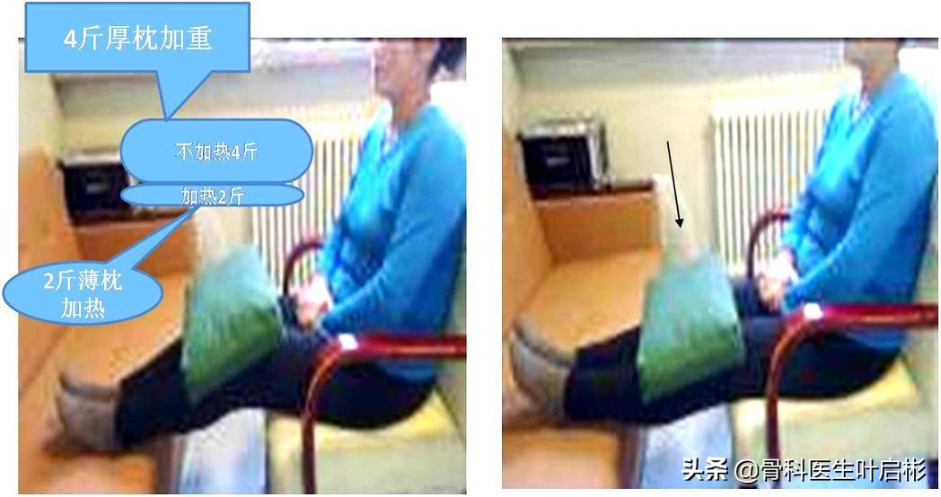 中老年男性常见的骨折,中老年人容易骨折怎么办