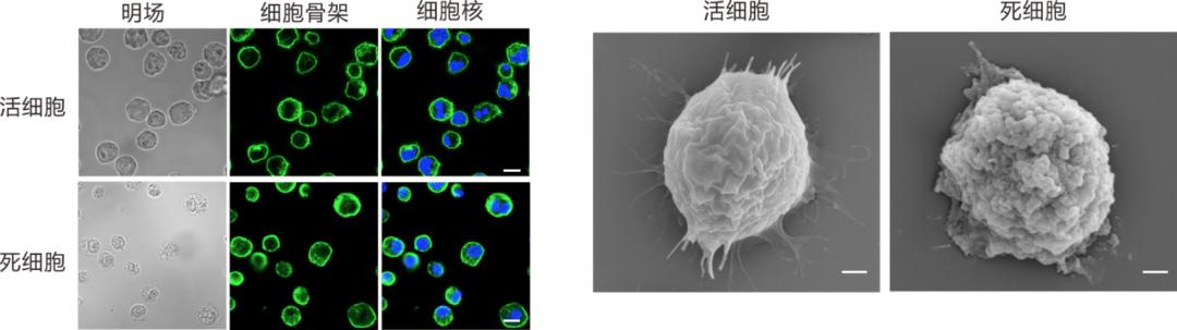 浙大药学院院长顾臻,液氮冷冻治疗干细胞