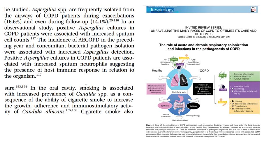 如何发现肺部真菌感染,怎样早期识别真菌感染