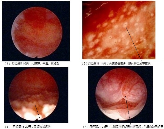 宫腔镜片子一般有几个图像,不学医的话懂看诊流程吗