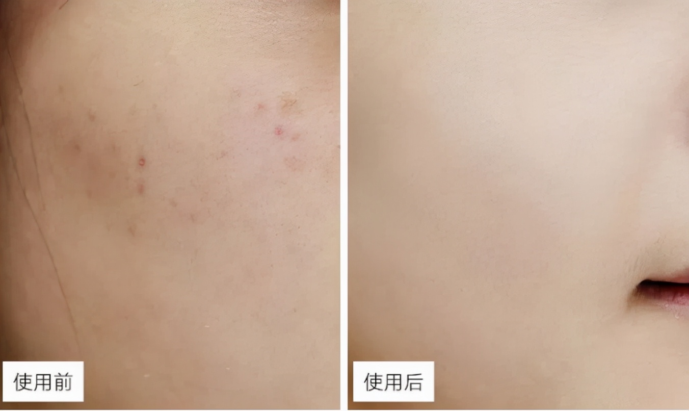 6款因太丑被误解的老国货,好用又便宜的就属这5款老国货