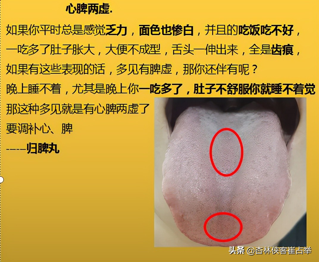 治疗失眠的十种中成药,治疗失眠多梦的中成药大全