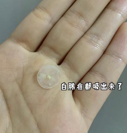 片仔癀净痘修护贴,抗痘贴片仔癀