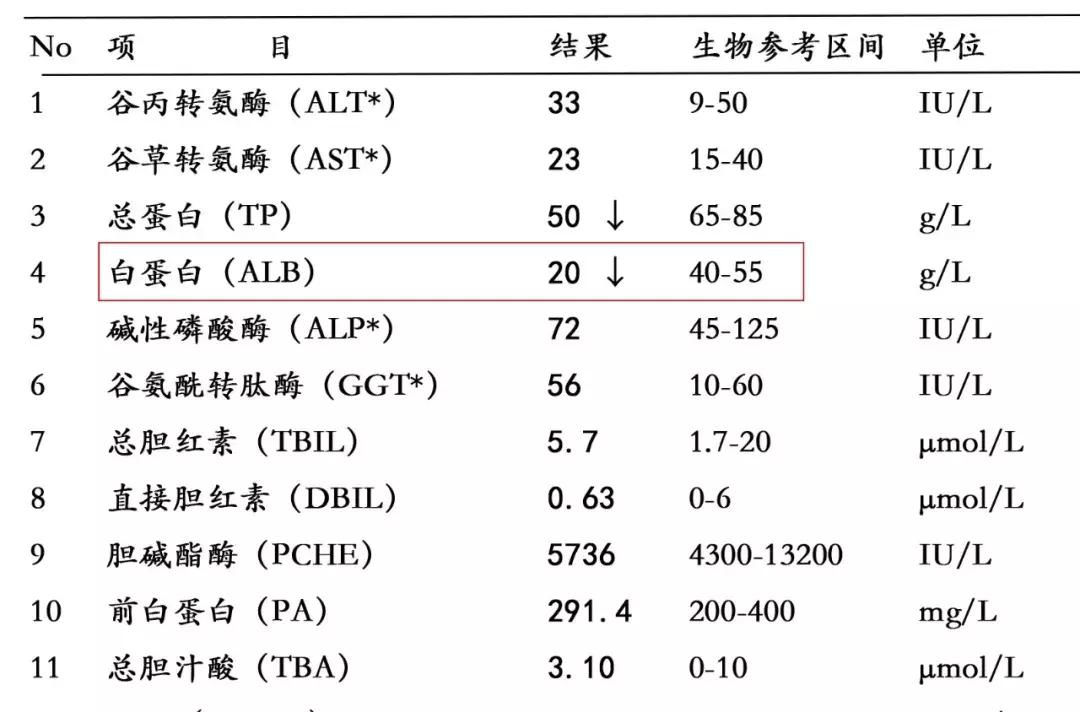 肾不好是上眼皮肿还是下眼皮浮肿,肾不好是双脚肿还是单脚肿