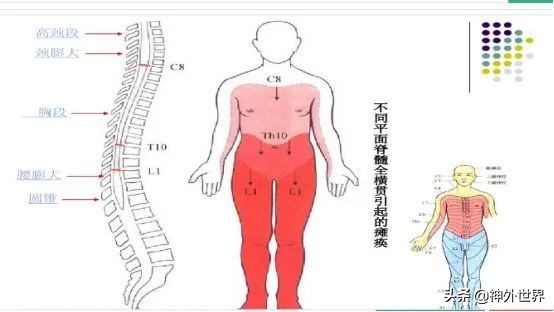脊髓损伤表现及定位诊断视频讲解,脊髓损伤平面的定位方法