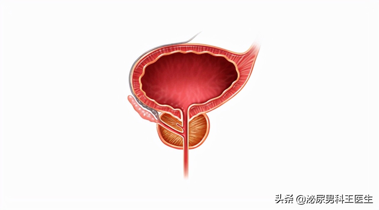 前列腺增生和前列腺肥大哪种严重,前列腺增生需要切除整个前列腺吗