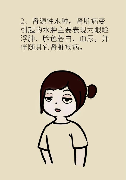 女性经期小腿以下水肿怎么办,起床肿怎么办