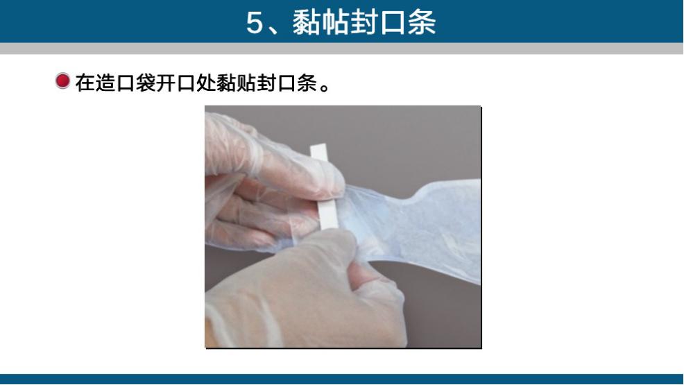 造口手术后多久复查一次,造口复查检查什么