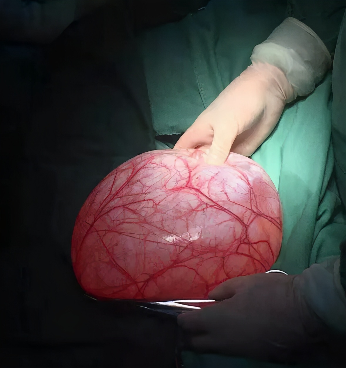 感动式服务医患,用心服务温馨相伴