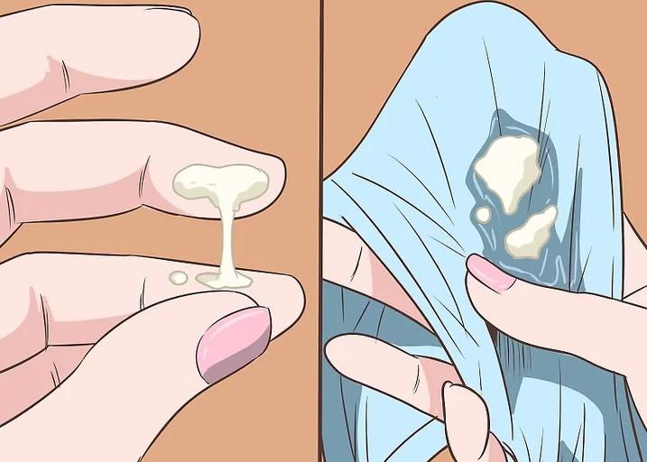 念珠菌性阴道炎的白带是怎么样的,念珠菌性阴道炎白带流出怎么回事