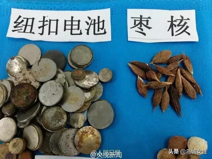 8岁男孩误吞5厘米钢钉,惊险9岁男孩误吞3厘米图钉