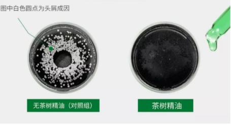 油头救星澳洲茶树洗发水,茶树精油酸性顺滑洗发水