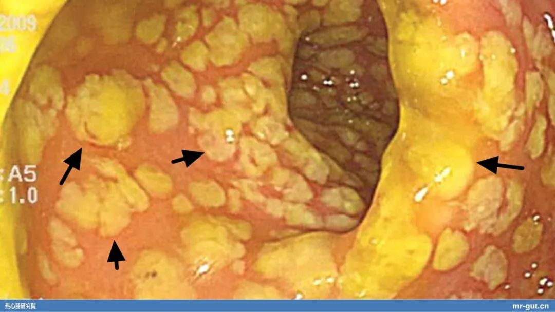 热心肠先生益生菌视频大全,热心肠先生全集