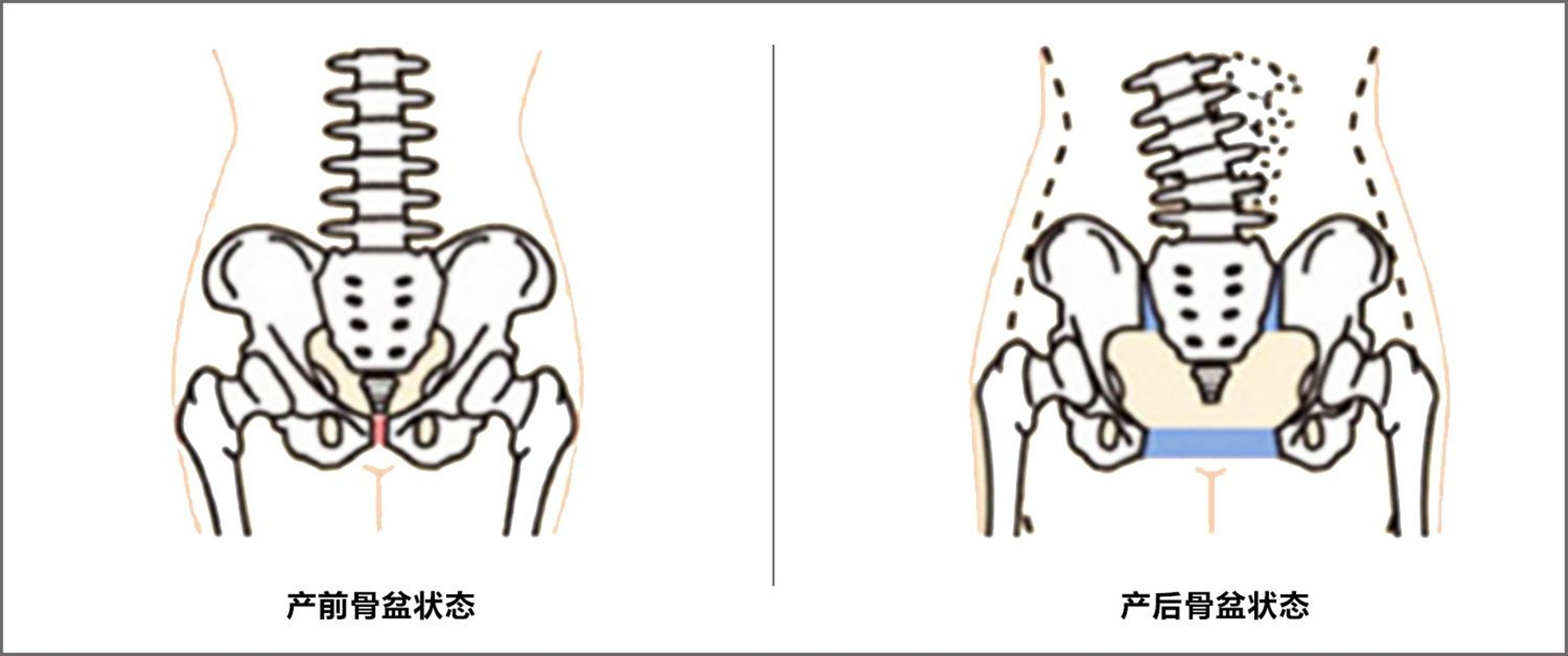 钟丽缇是什么类型身材,女性胯骨与男性胯骨对比
