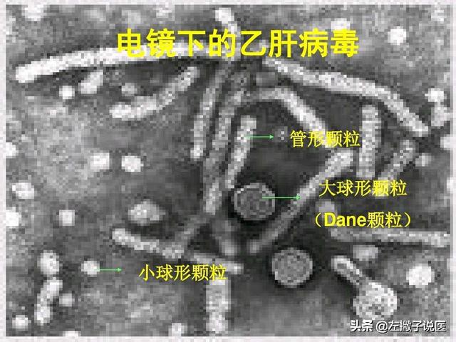 乙肝两对半245阳性属于正常范围吗,肝功能两对半245阳性正常吗