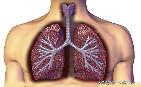体检报告说肺大泡,体检查出肺大泡这种病严重吗