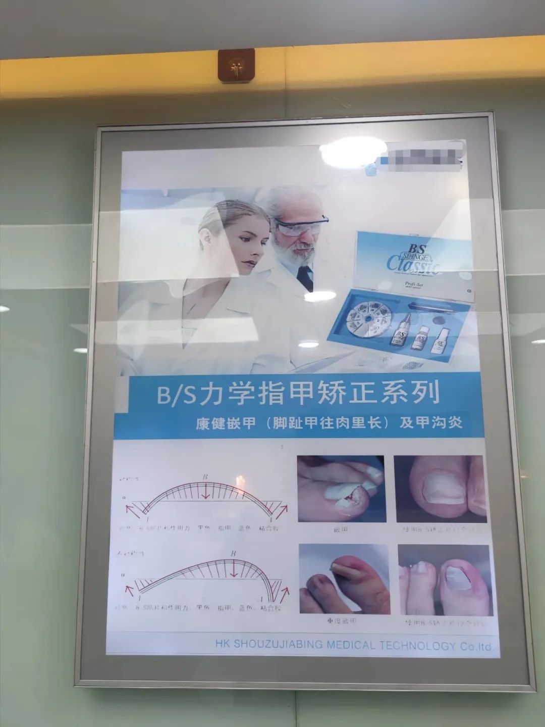 消毒抑菌凝胶可以治灰指甲吗,杀菌药可以治灰指甲吗