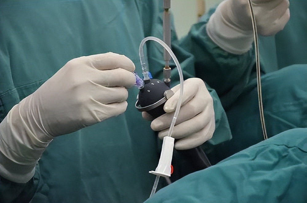 医院哪些检查令人尴尬,医院最尴尬的检查项目