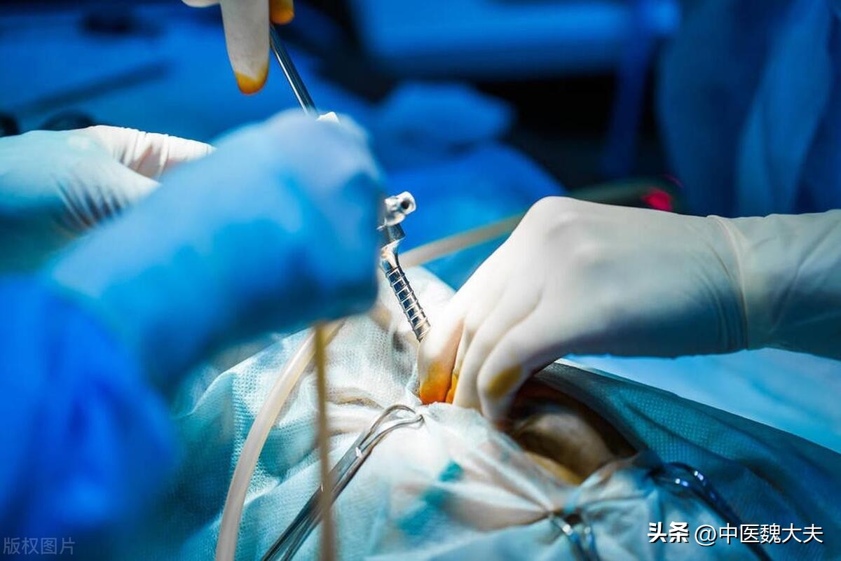 女性切除子宫后，还能进行“*生活性**”吗？提醒：这4种情况要注意