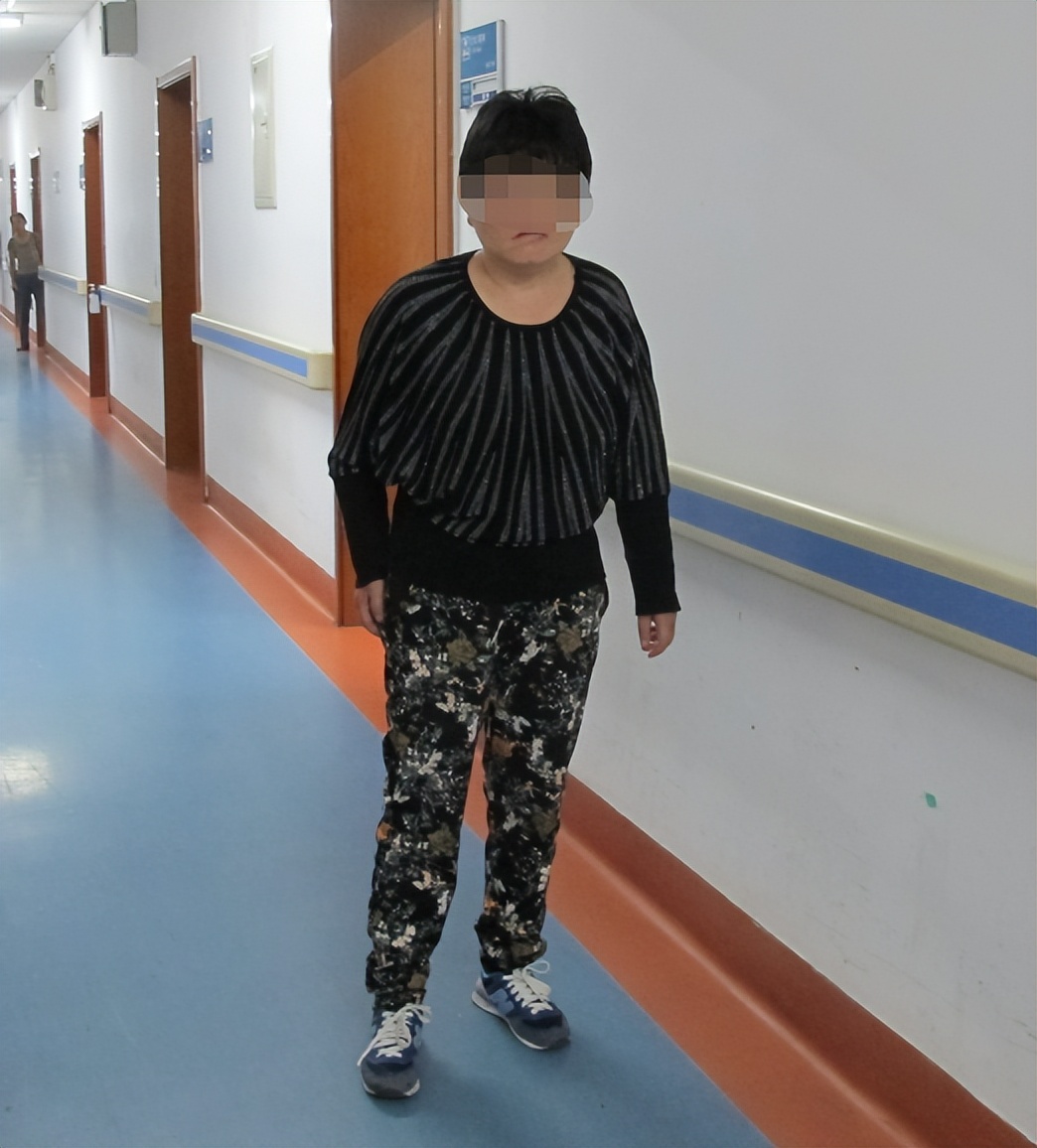 听神经瘤出现脑积水和出血,听神经瘤手术后颅压高症状