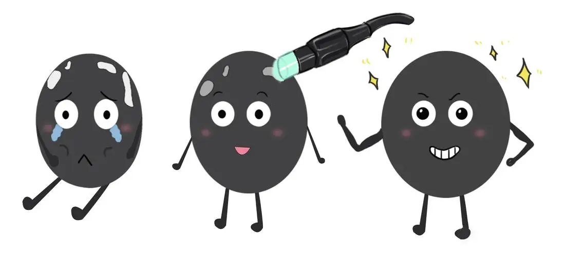 308nm准分子激光治疗白癜风,你所关心的问题都在这