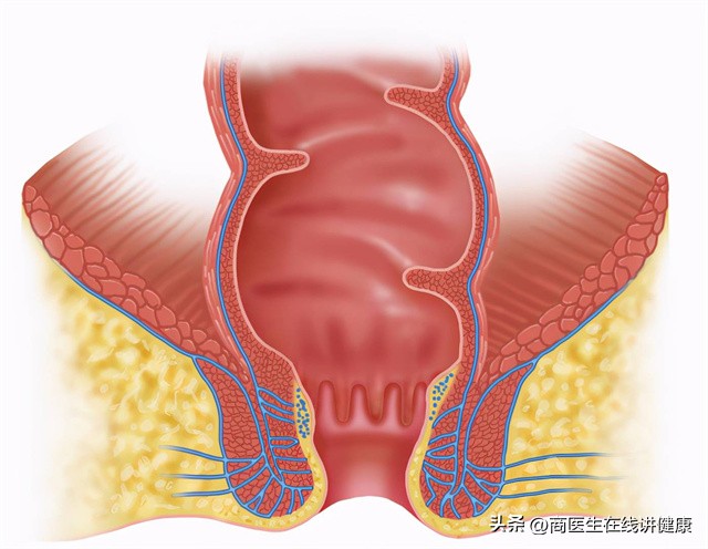 肛瘘手术快愈合了为什么有点痛,肛瘘引起脓肿不想手术