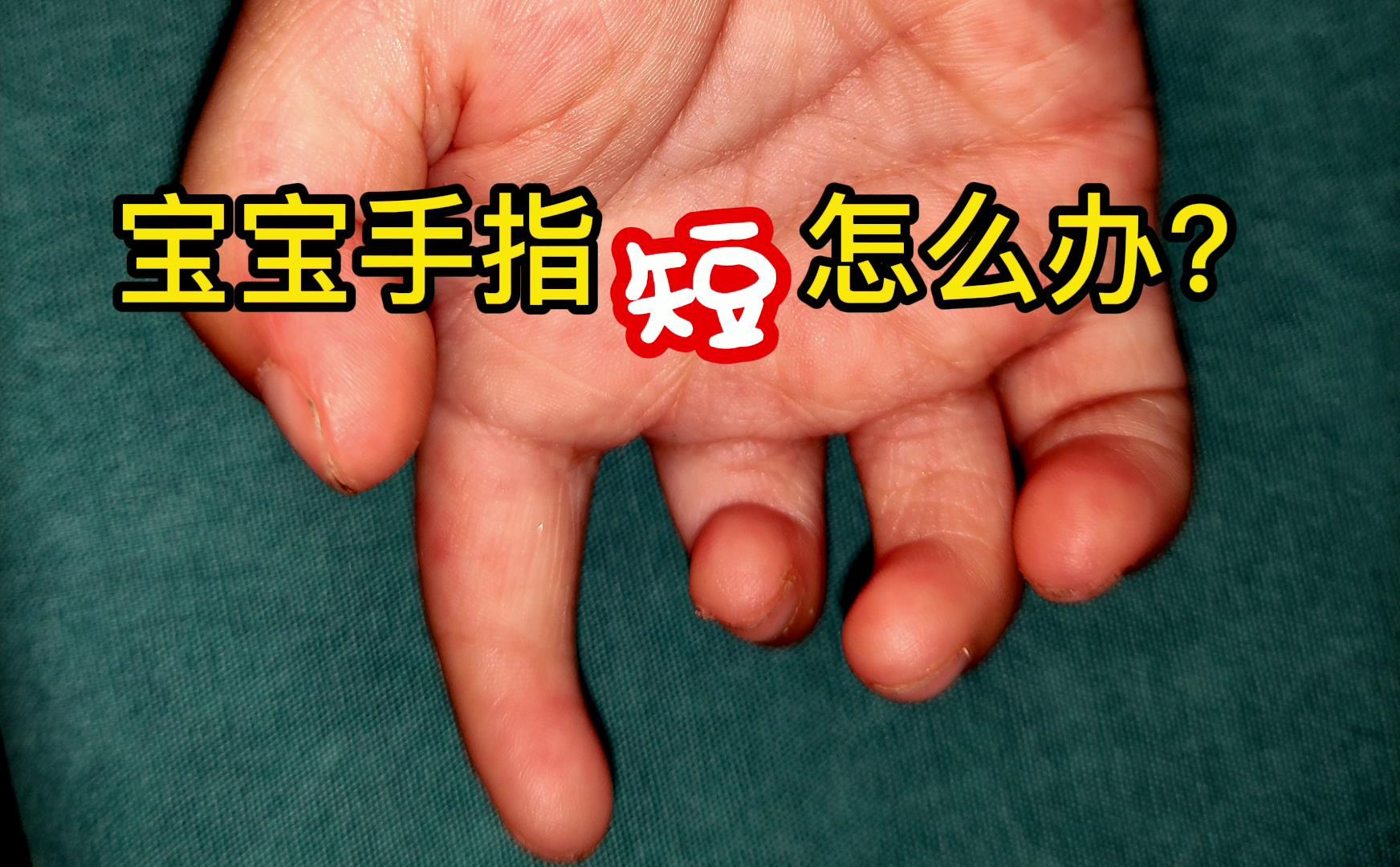 6个月宝宝手短,六个月宝宝手指肿胀怎么回事