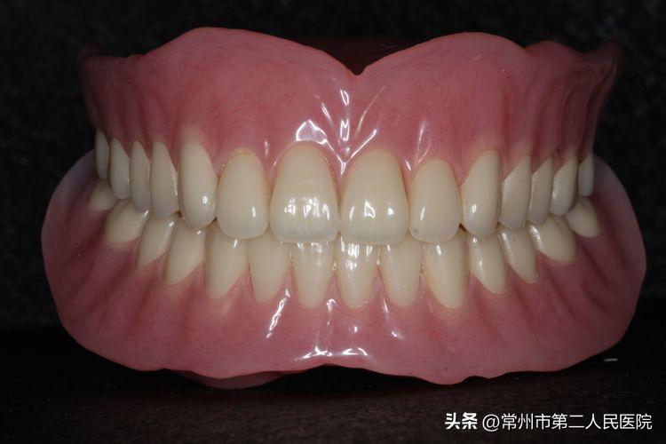 拔一边智齿第二天能正常吃饭吗,拔了一颗牙过了24小时正常吃饭吗