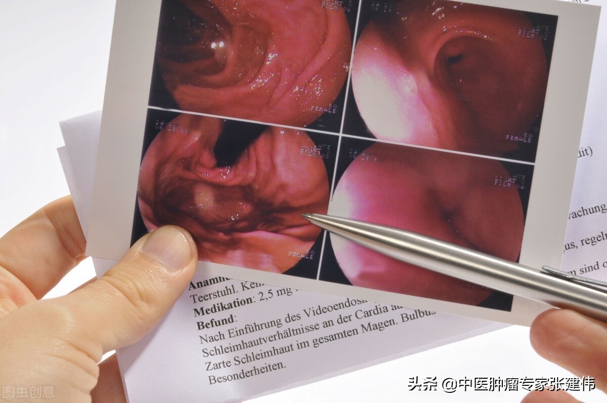 做胃镜痛苦吗哪三种人必须做胃镜,胃镜为什么不能随便做