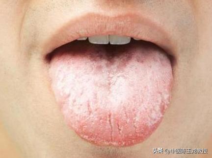 肾虚脚冷腰酸尿频,尿频腰酸是肾阳虚表现吗