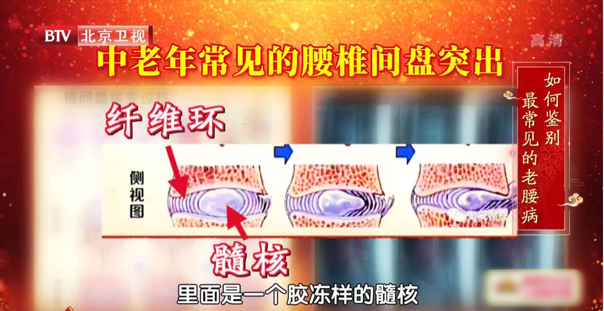 腰痛脊柱痛的最好解决办法,如何一个动作解决腰酸背痛