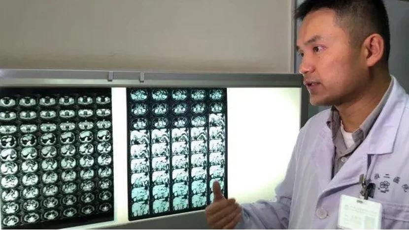 湘雅医院放射性粒子植入,湘雅放射性粒子植入