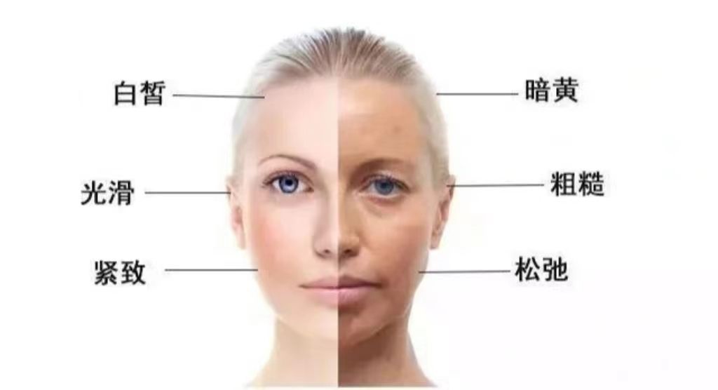 子婷祛斑,子婷祛斑怎么样