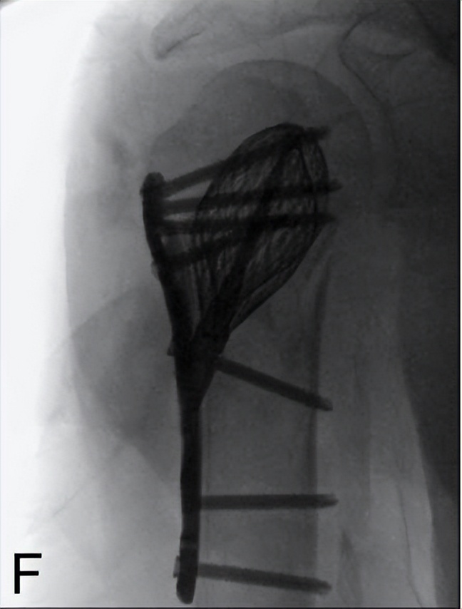 楠ㄧ闄堝崕,闄堝崕鍦ㄥ尰闄㈢殑瑙嗛